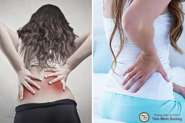 đau lưng sau sinh thường
