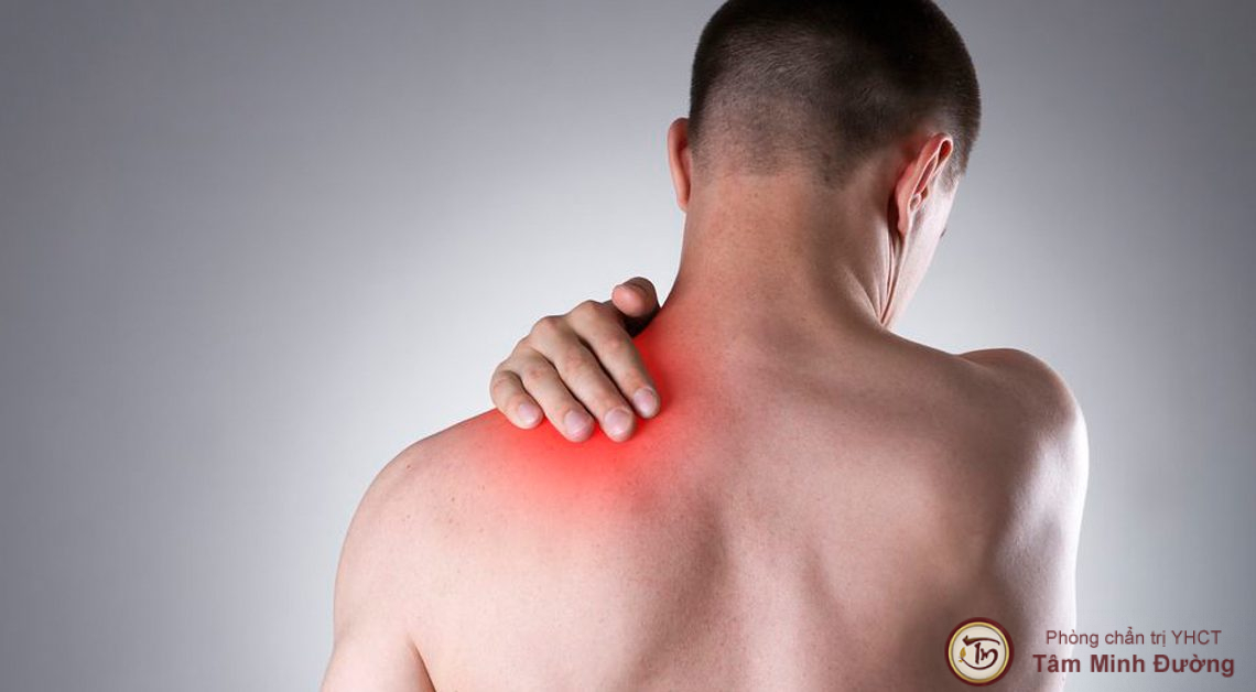 Có những phương pháp chữa trị đau mỏi vai gáy bên phải hiệu quả như thế nào?
