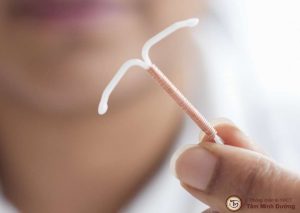 Tháo vòng tránh thai có đau không
