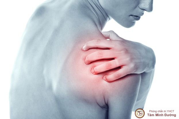 Sai, trật khớp vai là như thế nào?