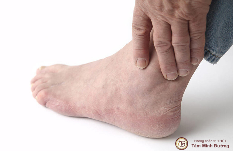 Có những biện pháp phòng ngừa nào để tránh đau khớp bàn chân?
