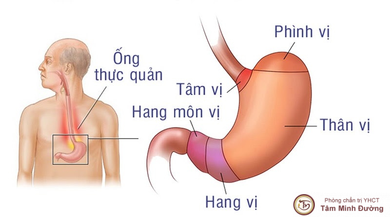 Triệu chứng của viêm hang vị là như thế nào?
