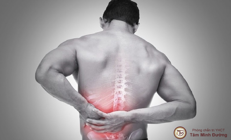 Có những biện pháp chăm sóc sức khỏe nào khác có thể giảm đau lưng bên trái khi cúi xuống?
