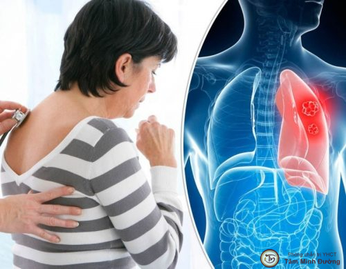 Tại sao chúng ta không nên chủ quan khi gặp đau ở vùng lưng sau phổi?
