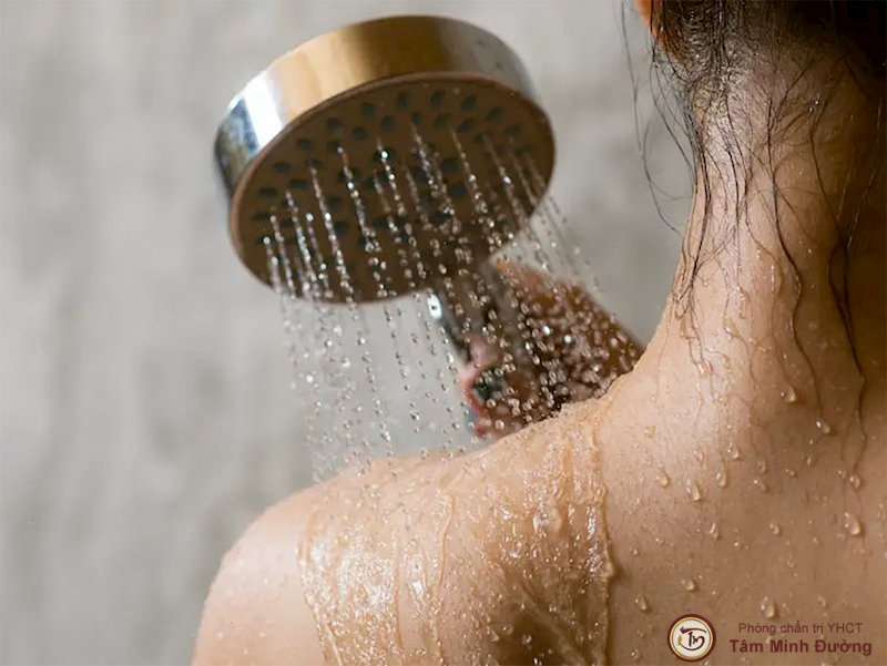 Nổi mề đay sau khi tắm nên làm gì?